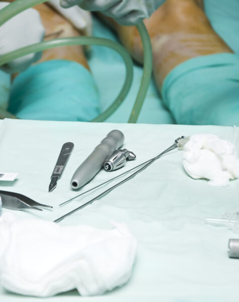 Liposuction surgery tools.